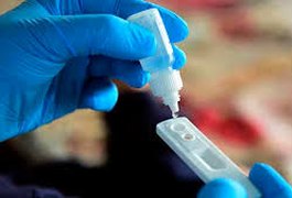 Alagoas registra aproximadamente 50 mil casos de covid-19; veja número de óbitos