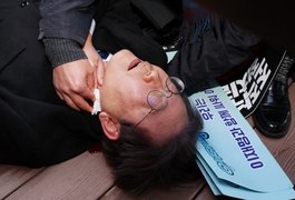 Político esfaqueado na Coreia do Sul se recupera depois de cirurgia