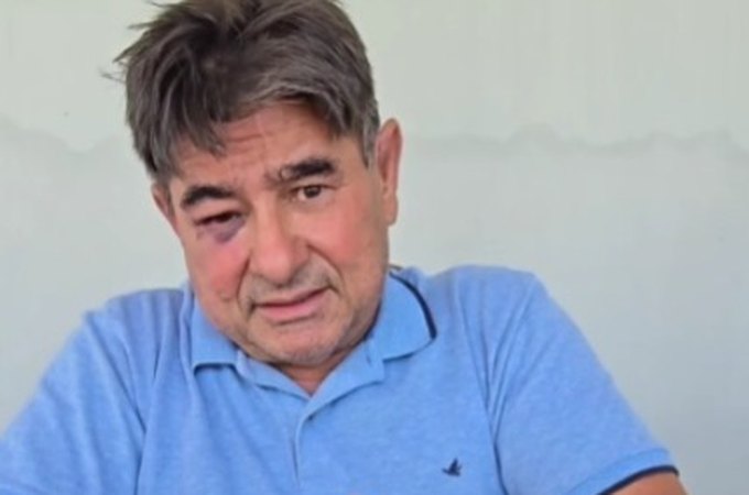 Ex-prefeito de Olivença, Mailson Bulhões se defende de acusação de agressão e afirma ter sido ele a vítima