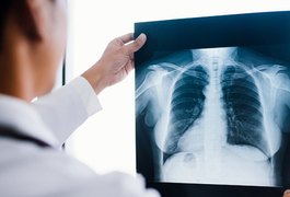 Saiba mais sobre a Fibrose Cística: condição genética que afeta pulmões e sistema digestivo
