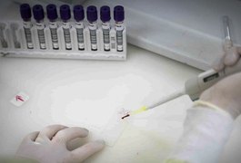 Paciente em SP com suspeita de ebola testa positivo para meningite
