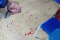 Justiça decreta internação provisória de estudante que baleou colega de sala, em Igaci