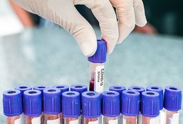 Boletim da Covid-19: 156 casos confirmados e três óbitos em Arapiraca