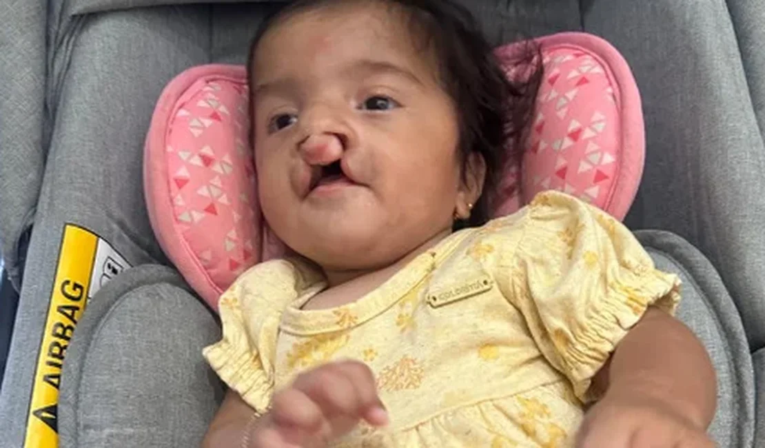 Família de bebê alagoana com malformações congênitas promove rifa para custear tratamento de saúde