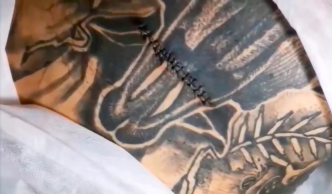 Jovens removem umbigo por estética e tatuam em cima