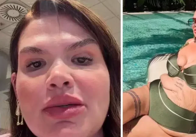 Thais Carla se prepara para cirurgia de remoção de pele após perder 120 kg