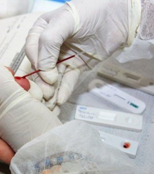 Maioria dos casos notificados de HIV em Maceió é de pessoas de 20 a 34 anos