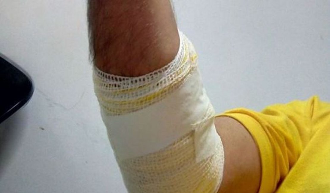 Agente da SMTT de Maceió é atropelado por motociclista durante perícia