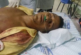 Jovem é alvejado por nove tiros em Teotônio Vilela