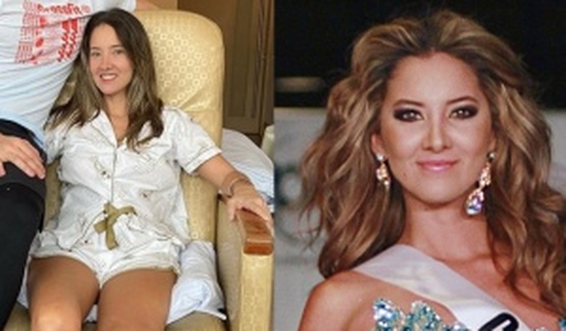 Miss Colômbia 2012 tem perna amputada após complicações em cirurgia de rotina