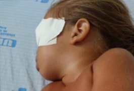 Bebê arapiraquense se recupera bem e não precisará extrair o olho