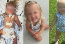 Menina de 18 meses tem as duas pernas amputadas por ter nascido sem um órgão
