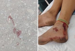 Grávida de cinco meses é vítima de estupro no interior de SP