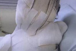 Mulher tem 95% do corpo queimado após ataque em bar de Aracaju