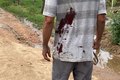 Homem é esfaqueado nas costas após discussão, na zona rural de Palmeira dos Índios