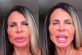 Gretchen mostra resultado de procedimento estético: 'Tudo novo'