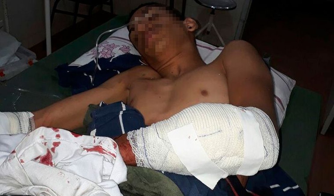 Assaltante toma susto ao se ver no espelho e atira contra o comparsa