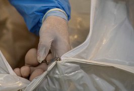 SARS-CoV-2 é detectado em gengivas de pacientes mortos no Brasil; entenda