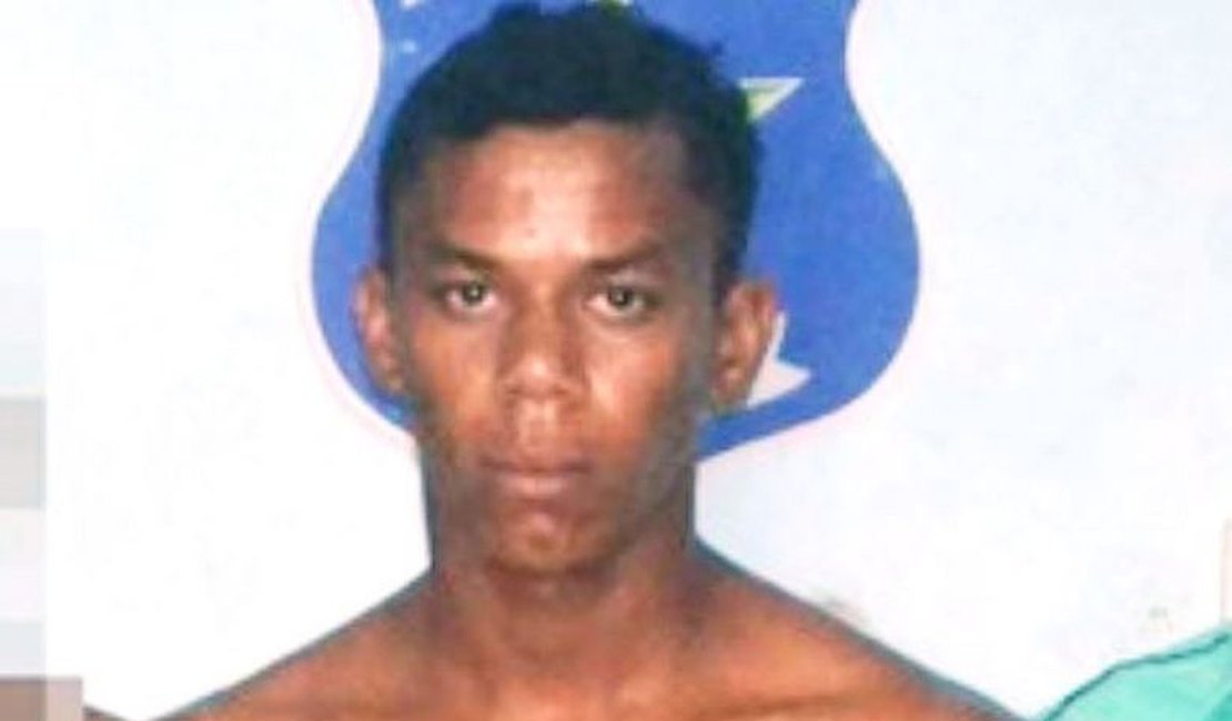 Justiça manda soltar homem que arrancou parte dos lábios da esposa com mordida