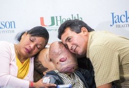 Morre menino cubano após cirurgia para retirar tumor que cobriu seu rosto por dois anos