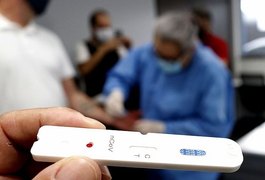 Ministério da Saúde confirma primeiro caso de reinfecção por Covid-19 no Brasil