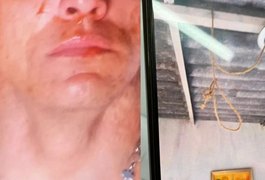 Homem simula tentativa de suicídio para tentar comover namorada após ela o denunciar por violência doméstica