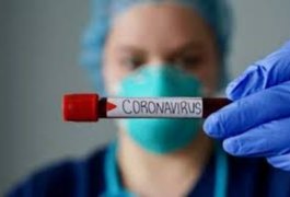 Cientistas investigam motivo de homens serem as maiores vítimas da covid-19