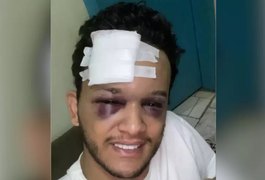 Cantor sertanejo sofre acidente em rodovia no MS e tem traumatismo craniano