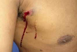 Agente penitenciário é baleado ao chegar em casa