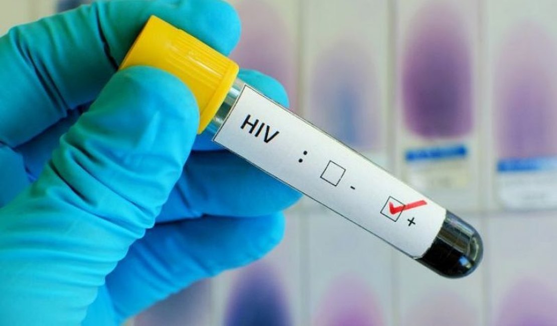 Casos de sífilis e de HIV/aids aumentam entre homens jovens