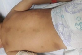 Mulher grávida denunciada por maus-tratos tenta justificar agressões contra filha de um ano, 'Ela bagunçava'