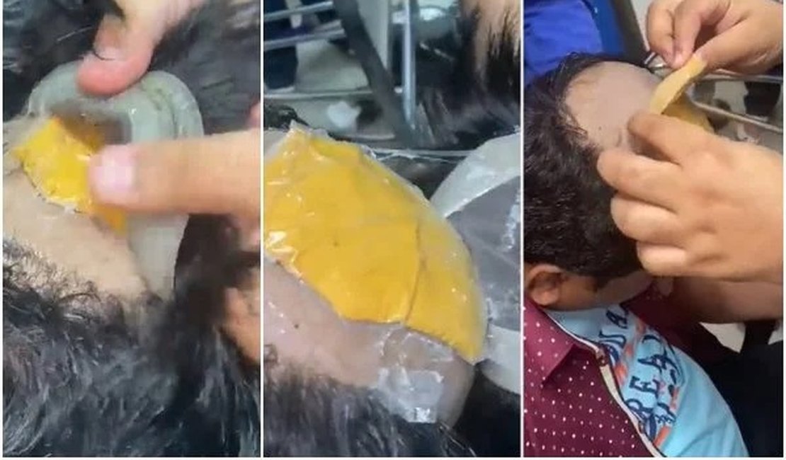 Contrabandista é preso ao ser flagrado com quase R$ 200 mil em ﻿ouro, ﻿dentro de uma peruca e no reto