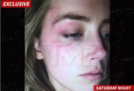 Esposa de Johnny Depp pede divórcio após agressão, diz site