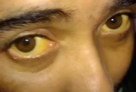 Arapiraquense com doenças que deixam os olhos amarelos e o corpo com marcas precisa fazer cirurgia