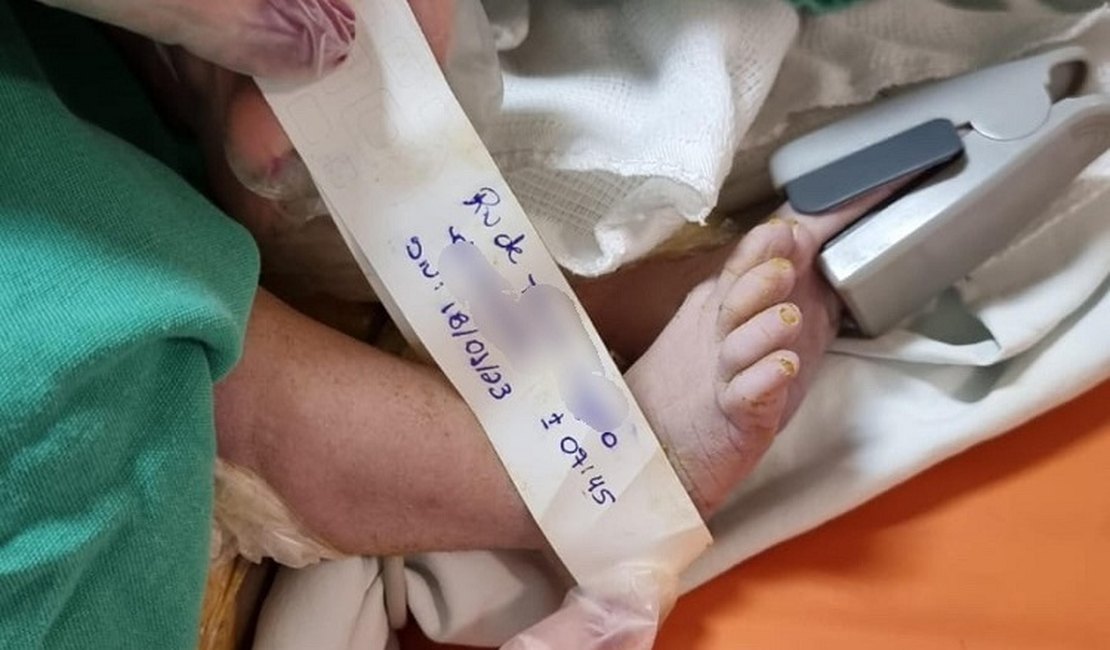 Socorristas do Samu AL atendem grávida com complicações no parto e salvam bebê em Maceió