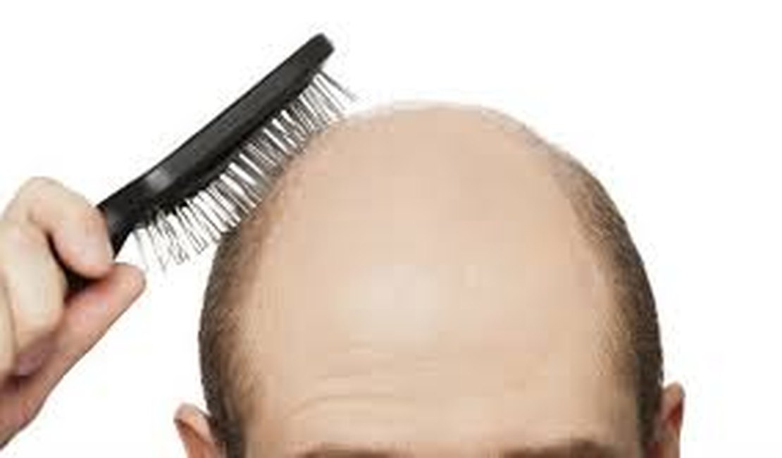 Remédio para artrite faz crescer cabelo – e muito – em homem careca