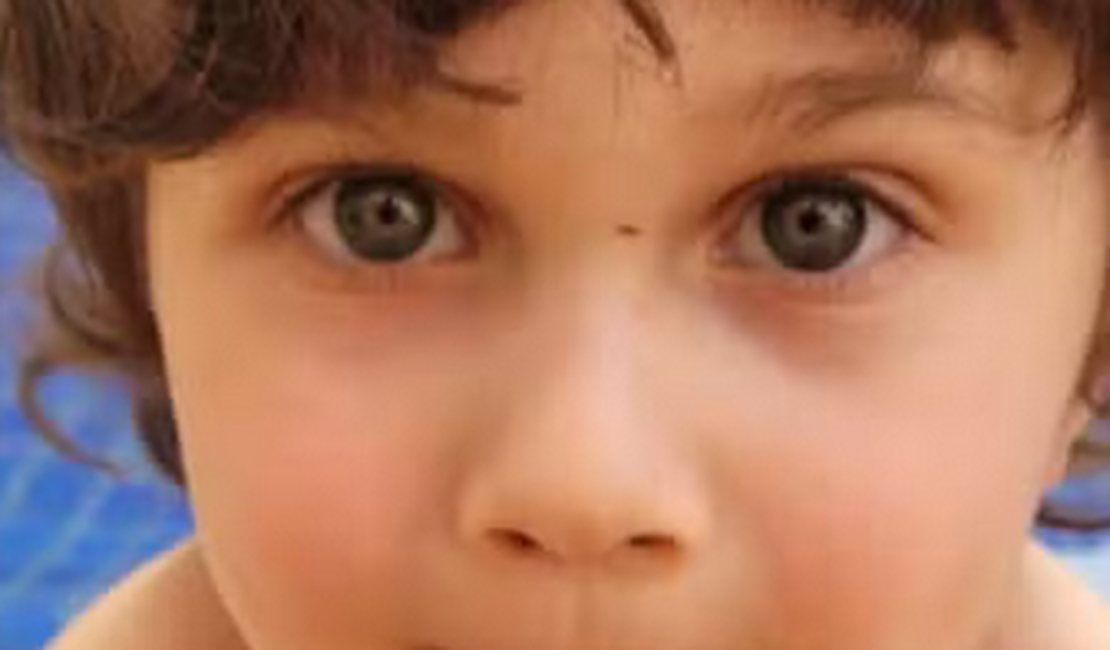 Menino de 4 anos que sobreviveu à queda do 10º andar de prédio quebrou as duas pernas