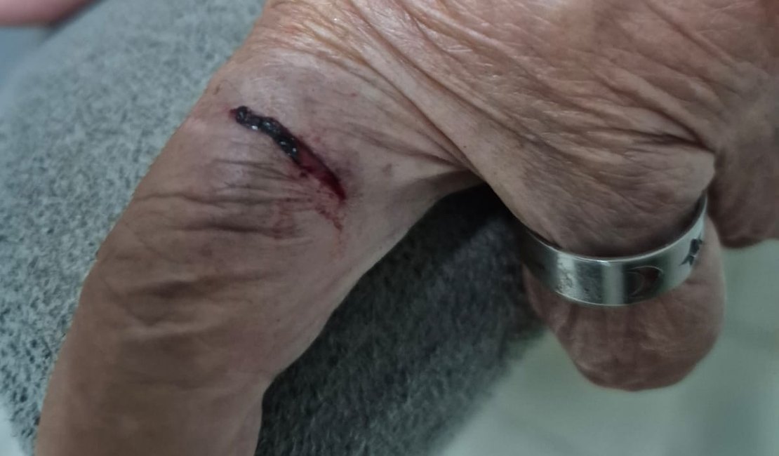 MP denuncia médica e representa filha adolescente por agressão e lesão contra idosa de 77 anos