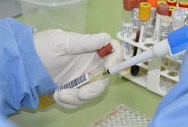 Com 7 casos este ano em Alagoas, Sesau reforça medidas de prevenção contra meningite