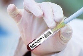 Coronavírus: pesquisadores estudam nova forma de testagem rápida