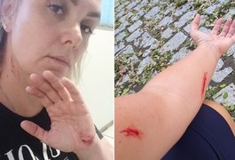 Vídeo: Advogado de ex-paquita afirma que ela estava 'se coçando' em vídeo