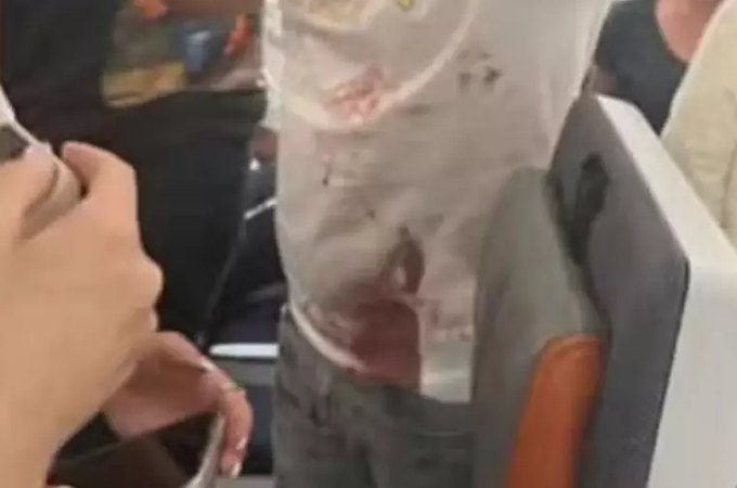 Passageiros relatam horror em voo para Israel após piloto ser esfaqueado