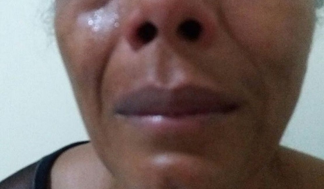 Atleta diz ter sido agredida e chamada de 'vagabunda' por PMs, em Maceió