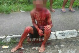 Homem é atacado a golpes de facão em Palmeira dos Índios