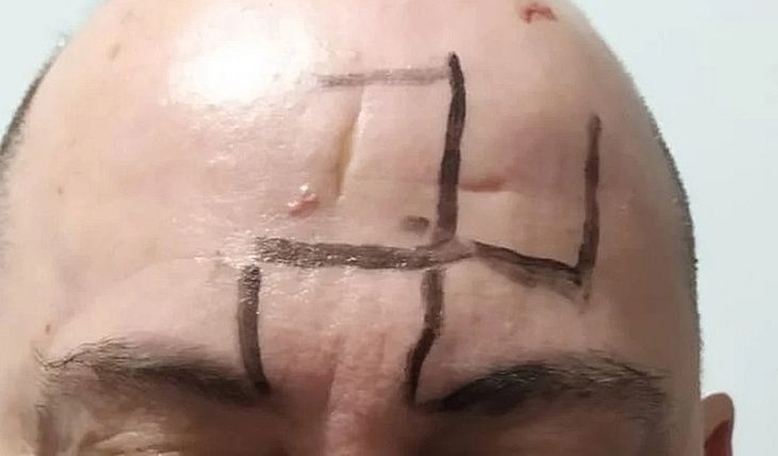 Homem é agredido e tem suástica desenhada na testa em ataque em MG