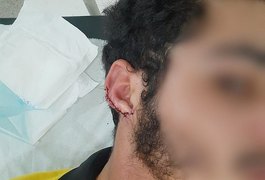 Atendente de lanchonete que teve orelha arrancada por cliente pede justiça
