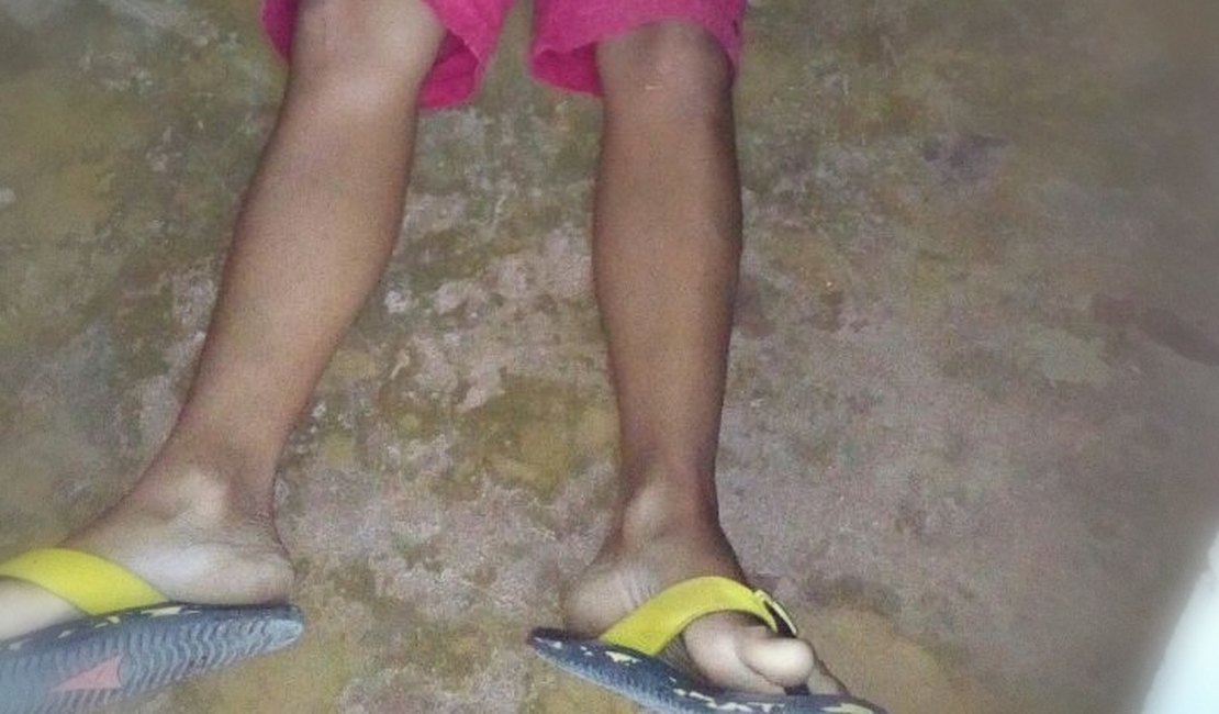 Adolescente morre e menor 'Papudinho' fica ferido após serem baleados em Arapiraca