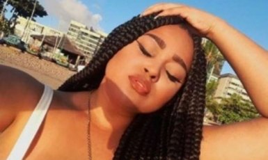 Ex-BBB alagoana sofre acidente com moto elétrica e revela fratura no olho