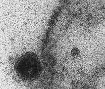 Aplicativo alimentado por tosses pode ajudar na detecção da covid-19