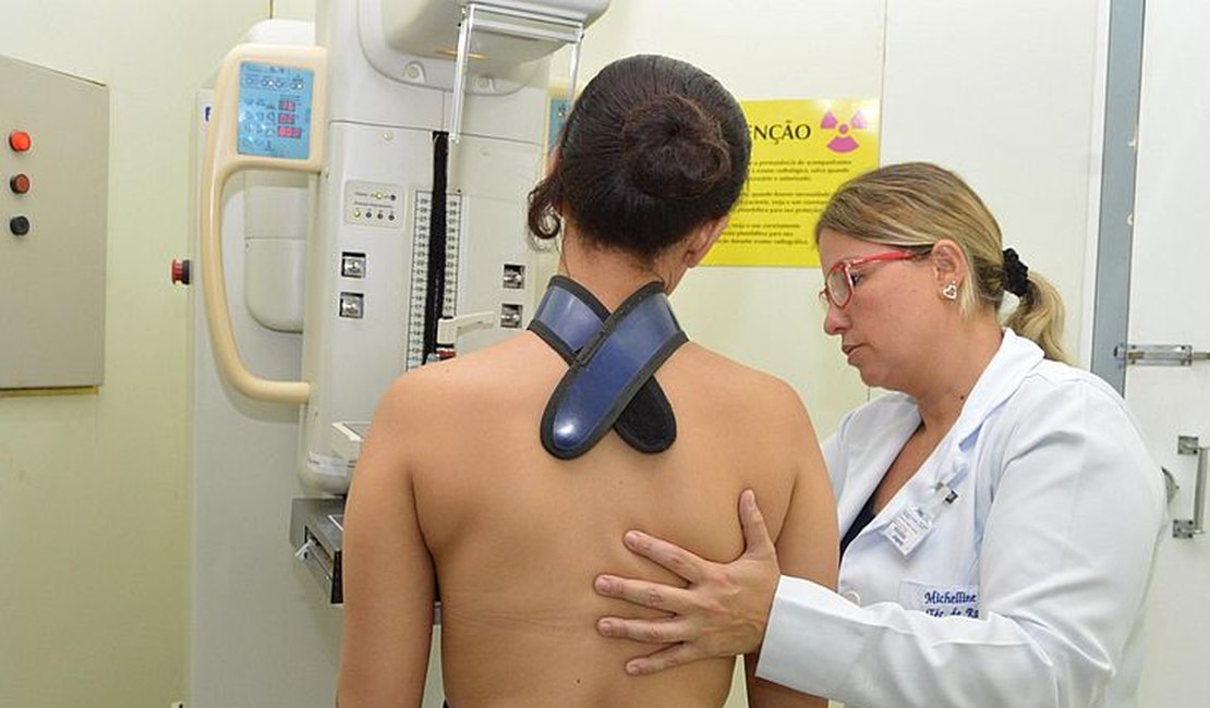 Sesau esclarece que vídeo sobre exames de mamografias sem agendamento não de hospital de Alagoas